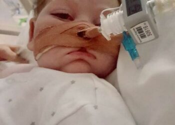 Charlie-Gard-eyes-fb