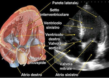 Minoli_65_00_apertura-cuore2-ecocardiogramma_720x495_ok