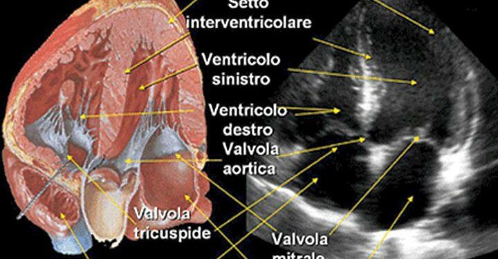 Minoli_65_00_apertura-cuore2-ecocardiogramma_720x495_ok