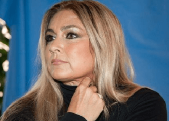 romina-power-prima-e-dopo-foto