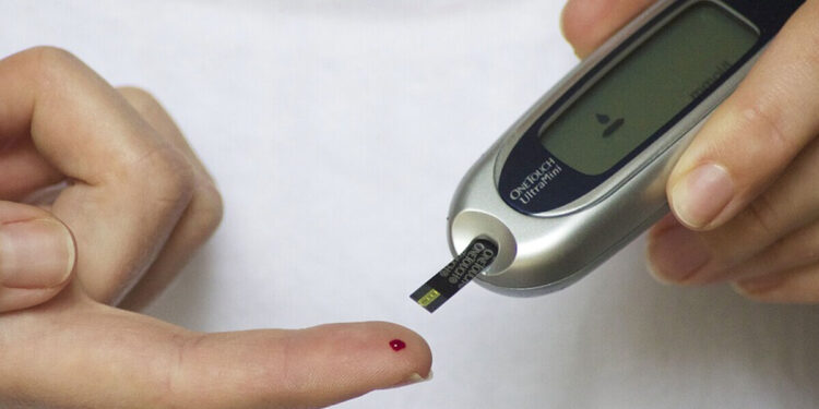 Diabete pediatrico: primo pancreas artificiale