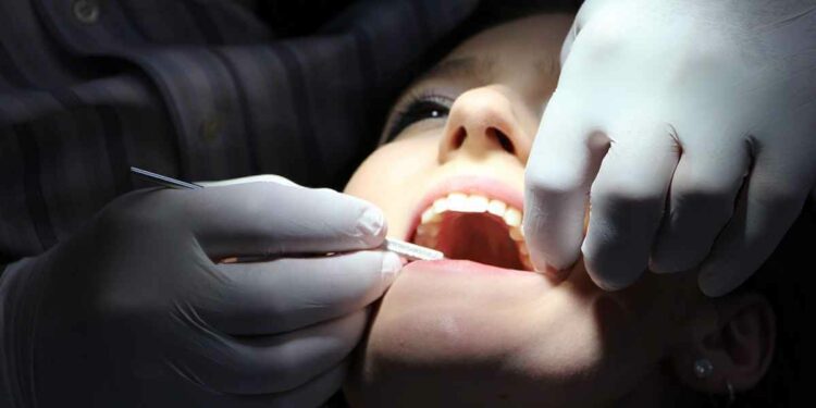 Problemi ai denti e legame con malattie cerebrali