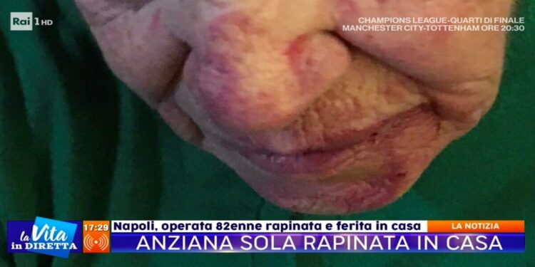 Napoli, anziana rapinata e accoltellata in casa