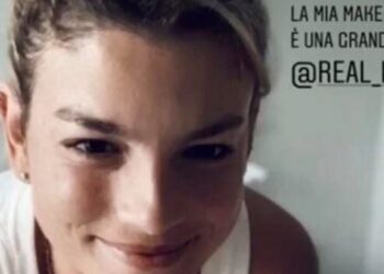 Emma Marrone, foto dopo operazione