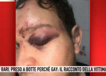 Picchiato perchè gay, Storie Italiane