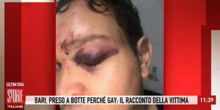 Picchiato perchè gay, Storie Italiane