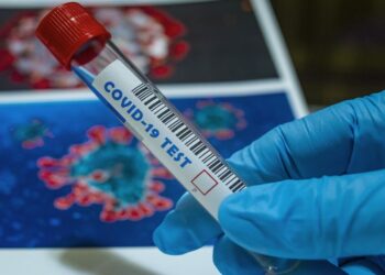 Test Coronavirus