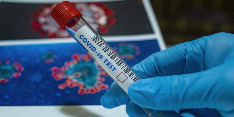 Test Coronavirus