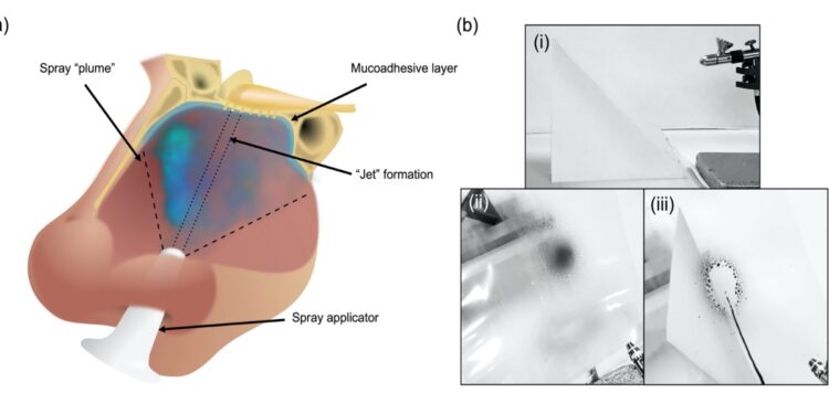 Spray nasale (Healthcare Technologies, Università di Birmingham)