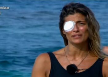 Elisa Isoardi con benda all'occhio, Isola dei Famosi 2021