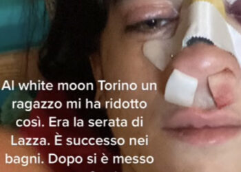 Su Tik Tok ragazza picchiata in discoteca a Torino