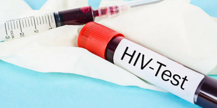 'Paziente di Ginevra', remissione da virus HIV