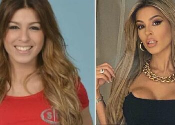 Oriana Marzoli prima e dopo